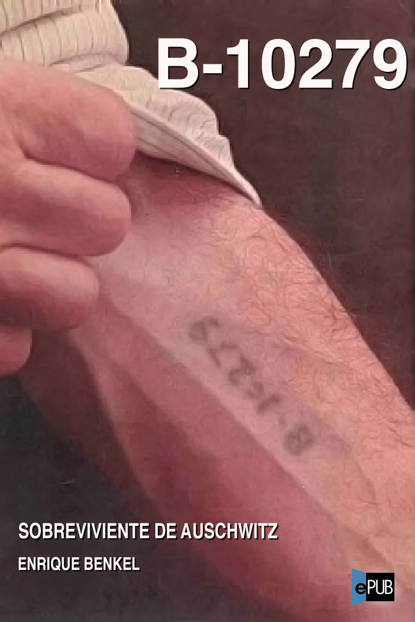 B-10279. Sobreviviente de Auschwitz
