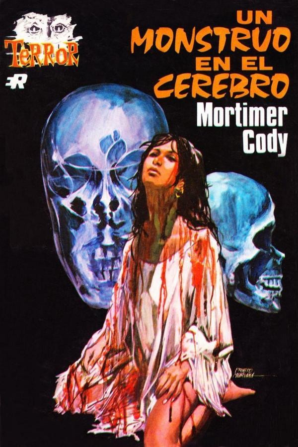 Un monstruo en el cerebro