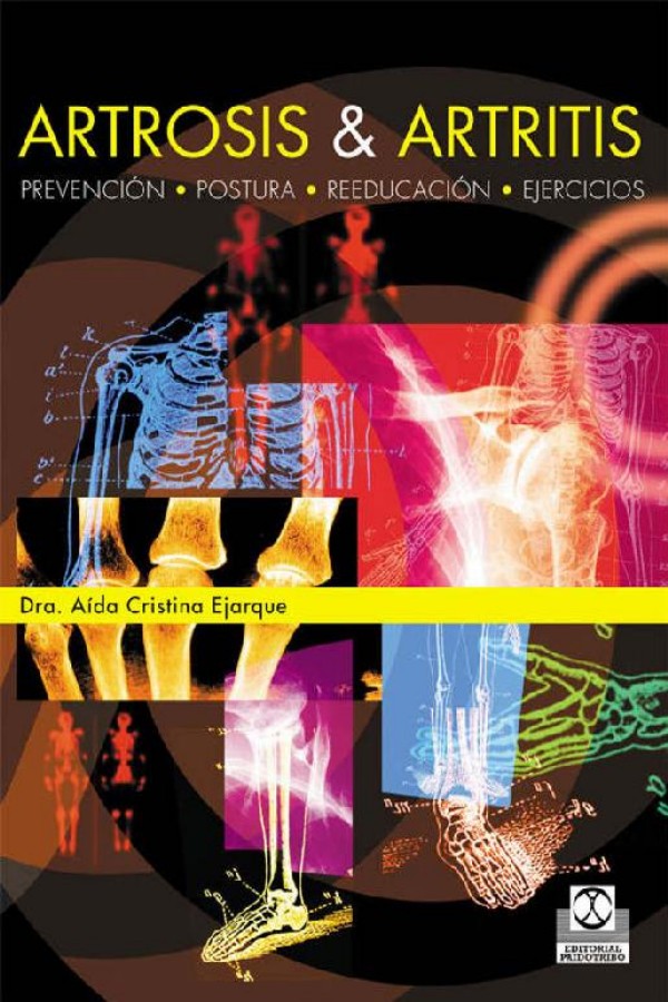 Artrosis & artritis
